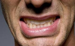 Бруксизм или скрежет зубами у взрослых и детей