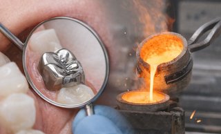 Цільнолиті коронки