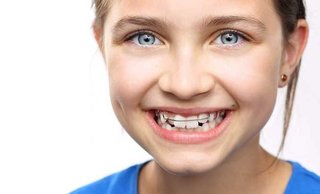 Пластинки для выравнивания зубов детям