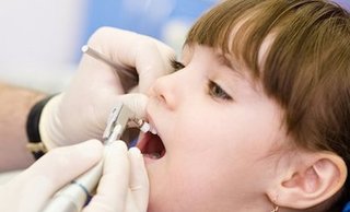 Профессиональная чистка молочных зубов у детей
